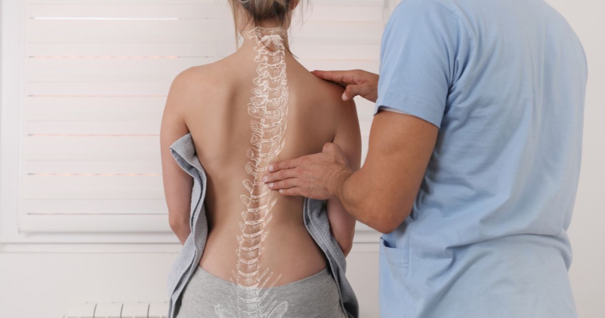 Manage Your Curve and Find Scoliosis Relief with Help From a Chiropractor for Posture