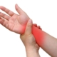 Is Chiropractic Massage Therapy Safe For Carpal Tunnel Syndrome?