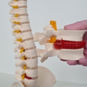 Herniated Discs and Chiropractic Massage: A Comprehensive Guide