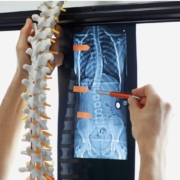 doctor looking at x ray of spine