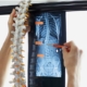 doctor looking at x ray of spine