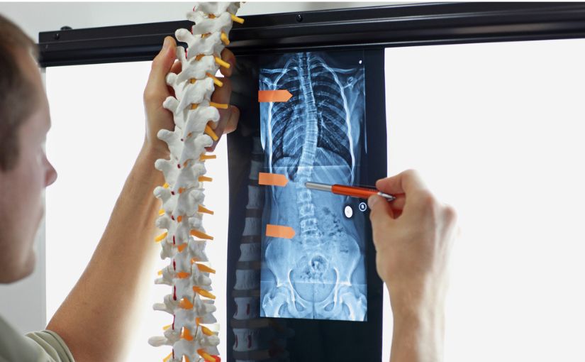 doctor looking at x ray of spine